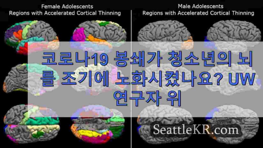 코로나19 봉쇄가 청소년의 뇌를 조기에 노화시켰나요? UW 연구자들은