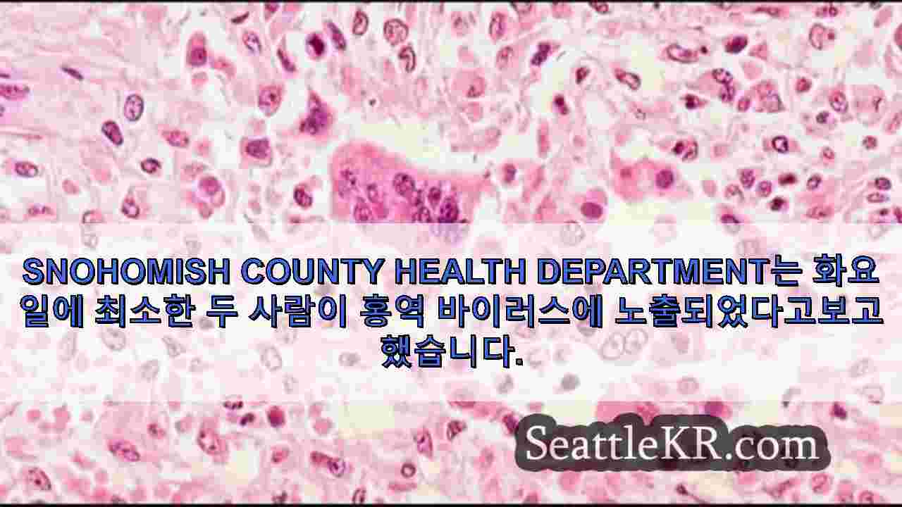시애틀 뉴스 SeattleKR