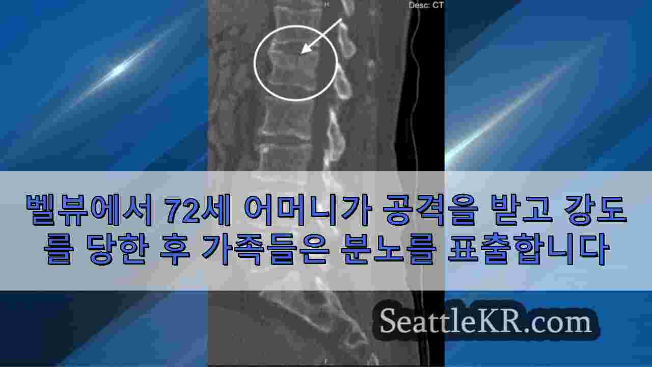 벨뷰에서 72세 어머니가 공격을 받고 강도를 당한 후 가족들은 분노를