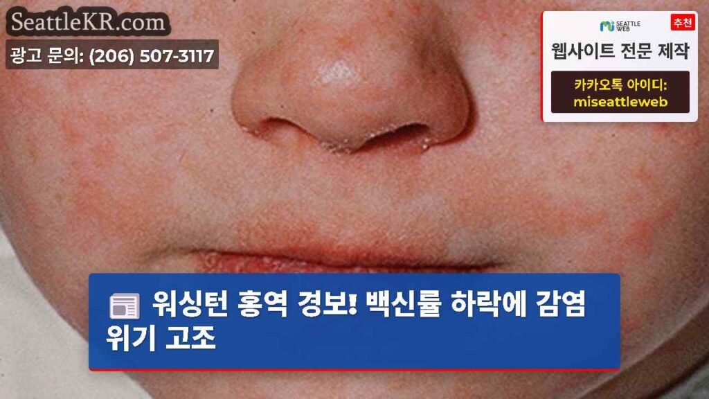 워싱턴 홍역 경보! 백신률 하락에 감염 위기 고조