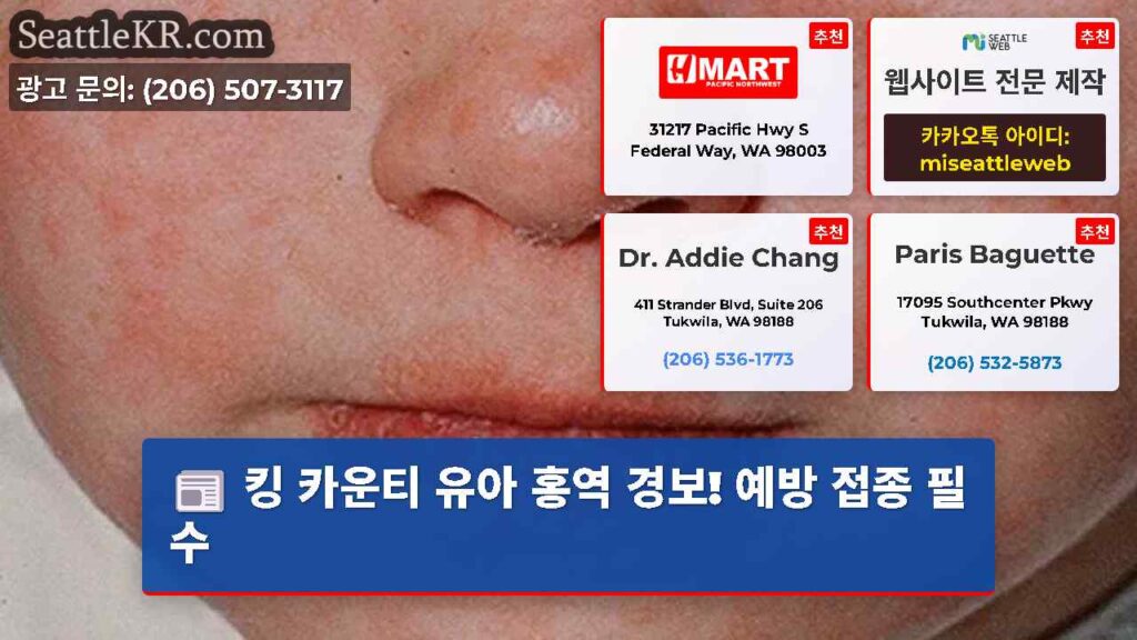 킹 카운티 유아 홍역 경보! 예방 접종 필수