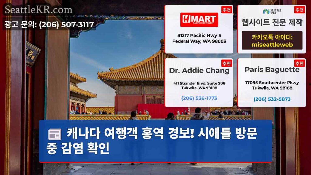 캐나다 여행객 홍역 경보! 시애틀 방문 중 감염 확인
