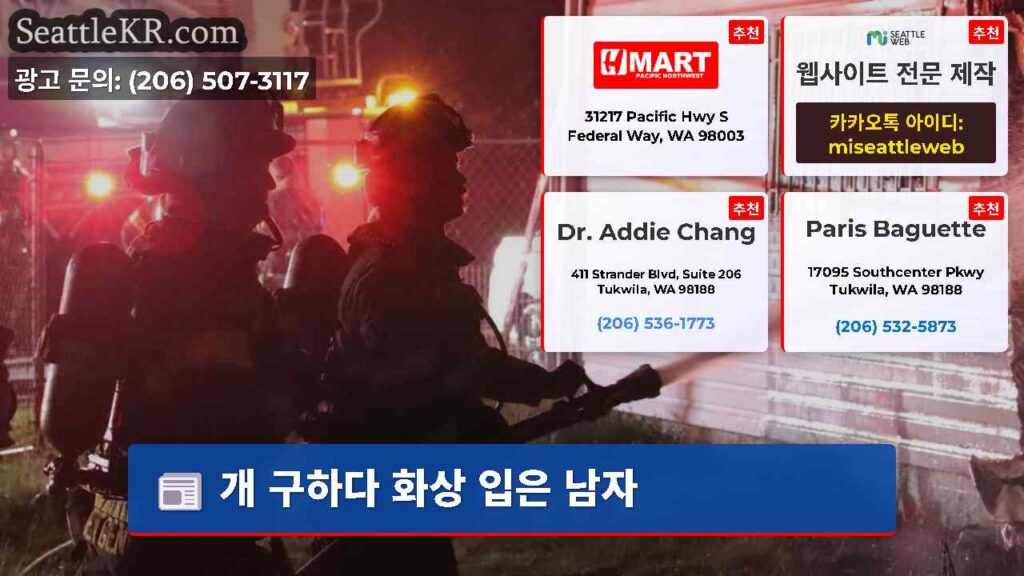 개 구하다 화상 입은 남자