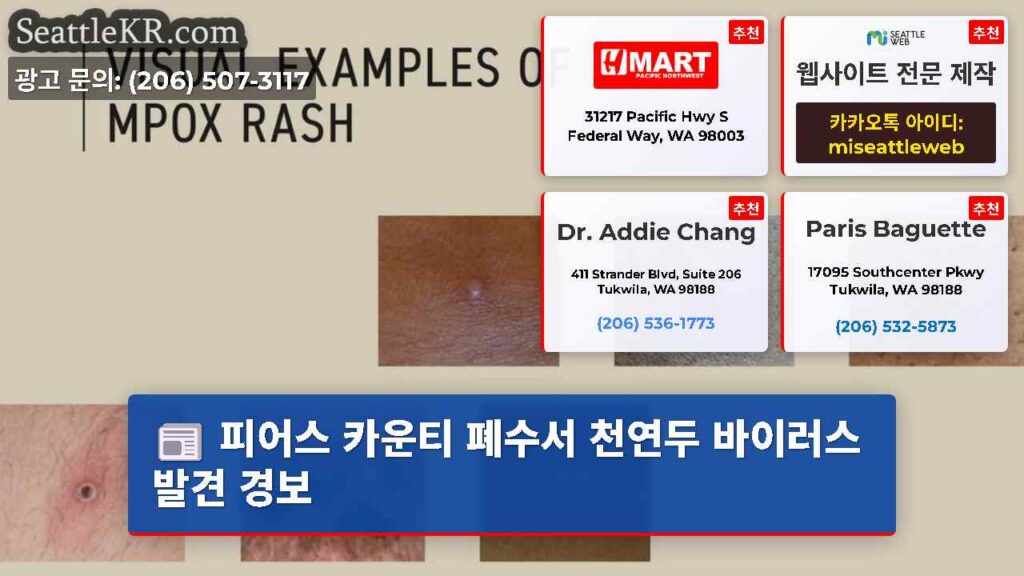 피어스 카운티 폐수서 천연두 바이러스 발견 경보