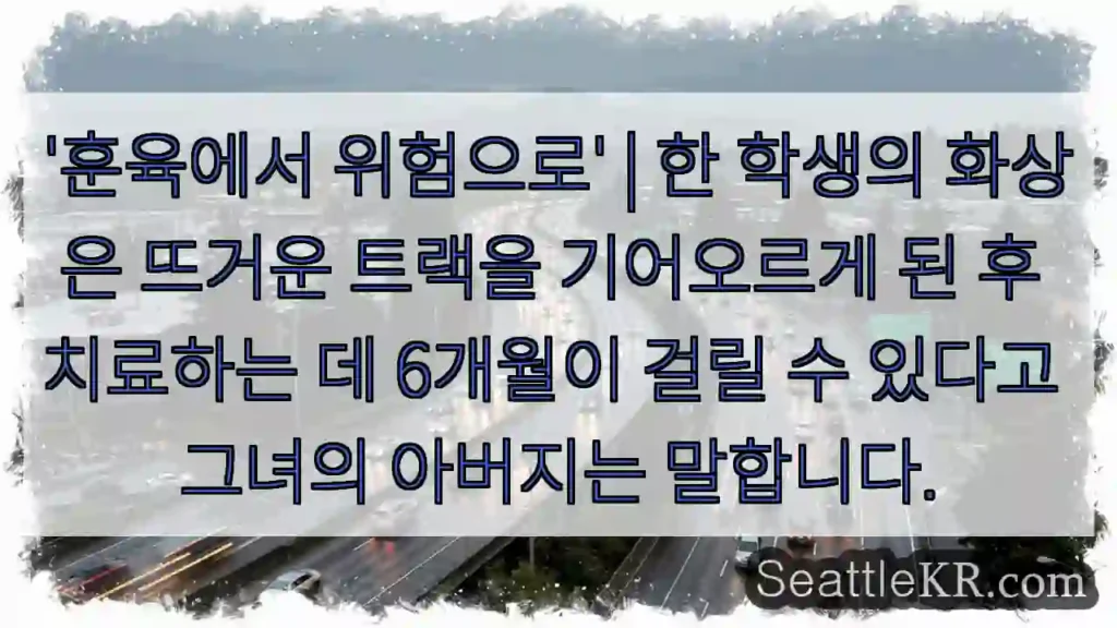 '훈육에서 위험으로' | 한 학생의 화상은 뜨거운 트랙을 기어오르게 된 후 치료하는 데