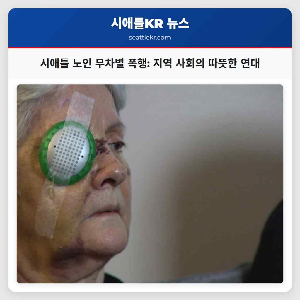 시애틀 노인 무차별 폭행: 지역 사회의 따뜻한 연대