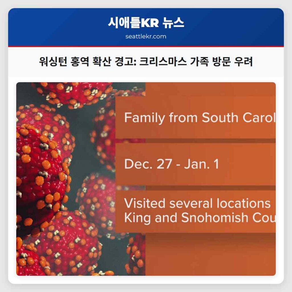 워싱턴 홍역 확산 경고: 크리스마스 가족 방문 우려