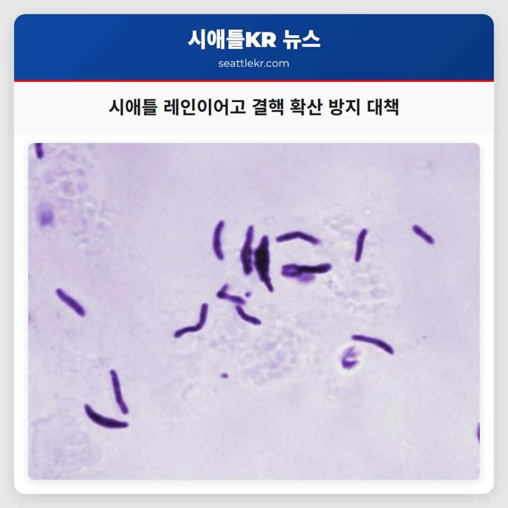 시애틀 레인이어고 결핵 확산 방지 대책