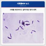 시애틀 레인이어 고등학교 결핵 확산 방지를 위한 적극적 대응