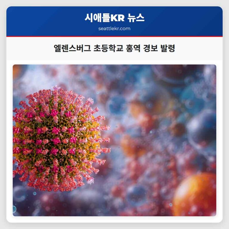 엘렌스버그 초등학교 홍역 경보 발령