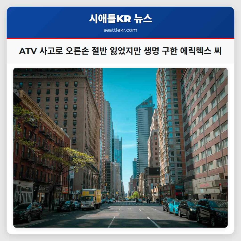 ATV 사고로 오른손 절반 잃었지만 생명 구한 에릭헥스 씨