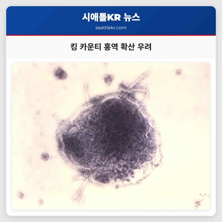 워싱턴 킹 카운티 해외 여행 연관 홍역 확산 우려 고조